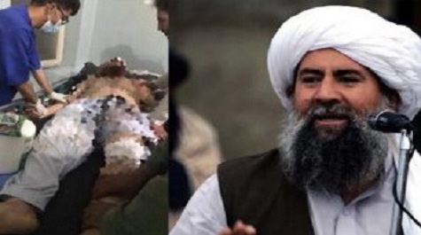 نیازی معاون گروه انشعابی طالبان توسط افراد ناشناس مجروح شد نیازی معاون گروه انشعابی طالبان توسط افراد ناشناس مجروح شد